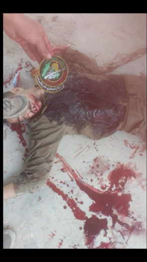 God is great.. 🔴📸 The Israeli soldiers occupying the land of Palestine were trampled on the head..