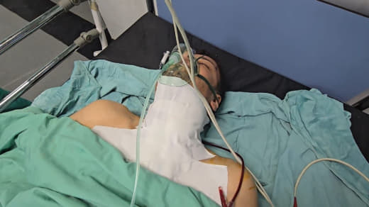 Urgent | Photographer #Al Jazeera Colleague Fadi Al-Wahidi enters a coma after his health deteriorates and the occupatio