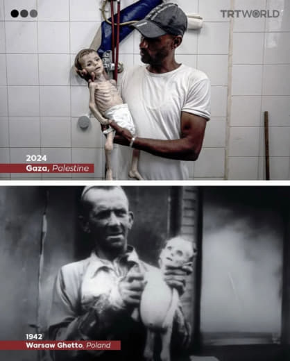 #Children #Gaza #Dying from #Starvation Leila Jeneid, toddler in Kamal Adwan Hopsital, in northern #Gaza 2024. The Nazis