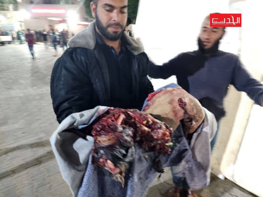 Cruel scenes for the mutilated victims of the lsraeli air attacks.