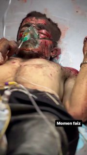 The bombs and missiles fired by the planes and cannons of the criminal #Israeli occupation army do not only kill or inju