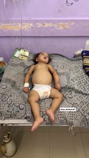 #Children #Gaza #Dying from #Starvation In a cramped room at Al-Aqsa Martyrs Hospital, little Habiba Nidal Al-Issawi, ju
