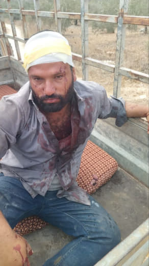 At least two injuries in a large-scale settler attack on the outskirts of Beit Lid village, east of Tulkarm in the north