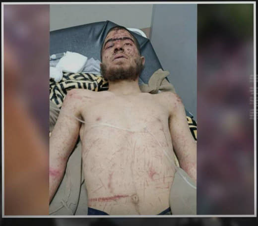 Settlers kidnapped a young Palestinian man and brutally assaulted him at the Ein Ayoub roundabout, west of Ramallah.