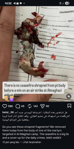 Al Maghazi camp Source : Belal Mo The sharpnels removed from the bodies of the martys targeted in zal Maghazi camp