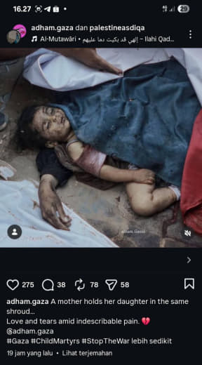 Source : Adham Gaza A mother holds her daughter in the same shroud... Love and tears amid indescribable pain. ❤️ .gaza