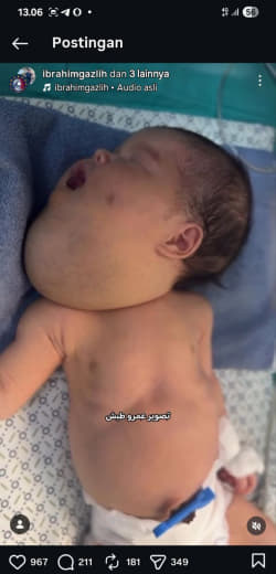 I wish someone can help much. Maybe we can try to spread this
