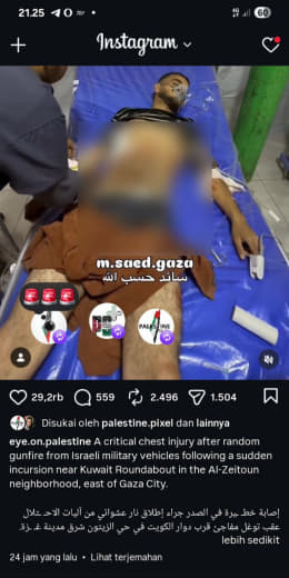 Al-Zeytoun neighborhood, East of Gaza City Source : Eye.on.palestine A critical chest injury has been reported following