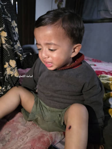 🚨 In a barbaric crime, the IOF detained and tortured a 1-and-half year old child, Kareem Abu Nassar, to coerce a confess