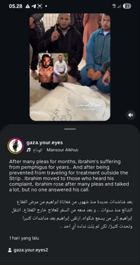 After months of desperate pleas, Ibrahim—who had suffered from pemphigus for years and was denied travel for treatment o