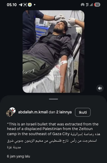 "This is an Israeli bullet that was extracted from the head of a displaced Palestinian from the Zeitoun camp, southeast 