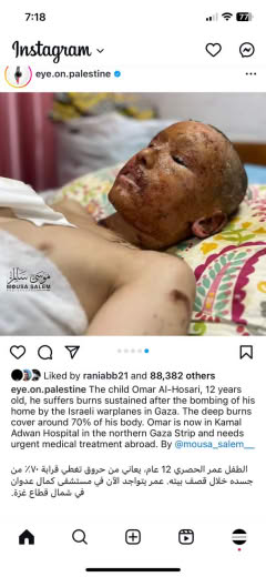 4/3/24 @eye.on.Palestine