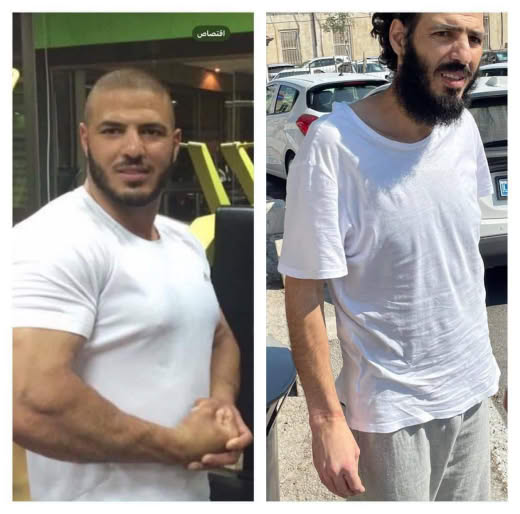 A photo shows Fadi Issawi, a Palestinian man and Islamic Waqf guard of the Al-Aqsa Mosque, before and after his detentio