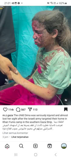 Khan Younis Camp, Southern Gaza Posted at 15 08 2024