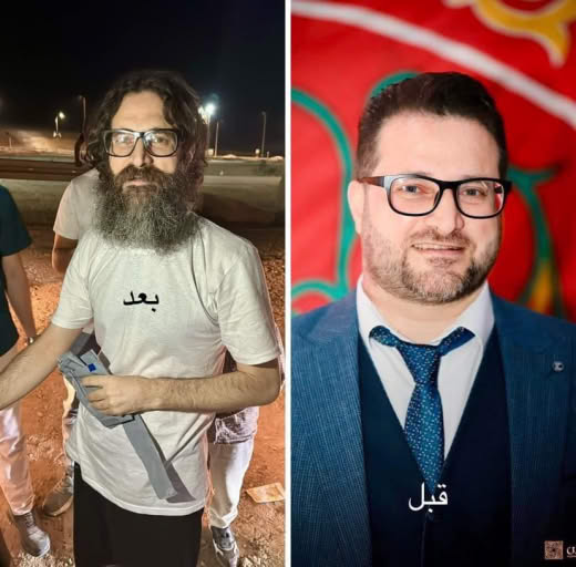 Ayham Al-Qawasma, a new prisoner breathing freedom >> ((Before and after))