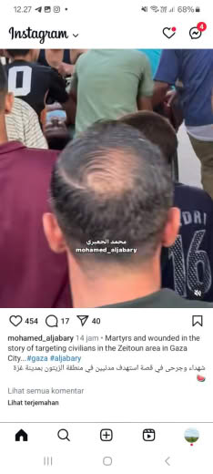 Zaitoun Area, Gaza City Posted at 27 08 2024
