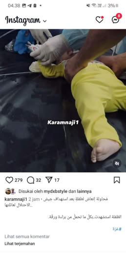 Date : 06 10 2024 Source : Gazan journalist Karamnaji1 instagram account Location : Gaza