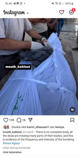 Date of incident : October 11, 2024 Source : Moath Kahlout Gazan journalist IG feed Location : Gaza