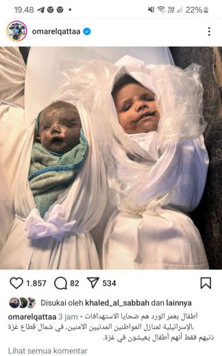 Source : Omar El Qattaa,Gazan journalist IG feed Date of incident : 12 10 2024 Location : Gaza