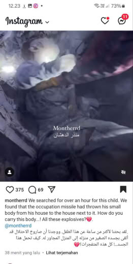 Source : Monther R.D.