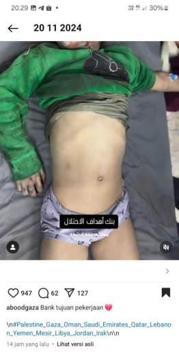 Source : Abood Abusalama