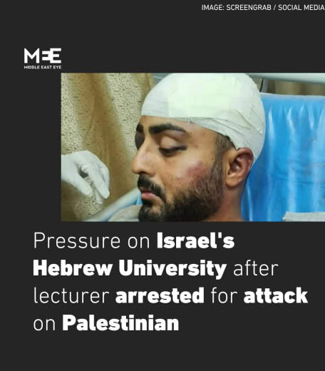 📰 Pressure on the Hebrew University of Jerusalem is growing after one of its lecturers, criminologist Michael Wolfowicz,