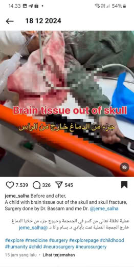 Source : Jame Shalha