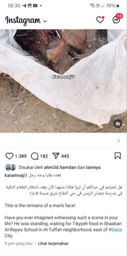 More information about this case: Shaaban Al Rayyis School, Al Tuffah Neighborhood, East of Disability Source : Karamnaj