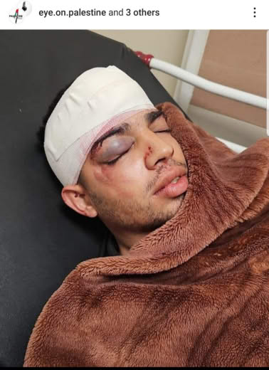 19/1/2025  @eye.on.palestine