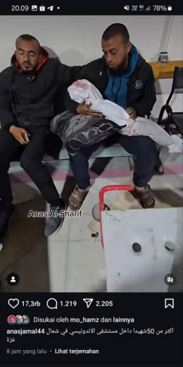 Location of incident : North Gaza Location of the footage : Indonesian Hospital, North Gaza Source : Anas Al-Sharif