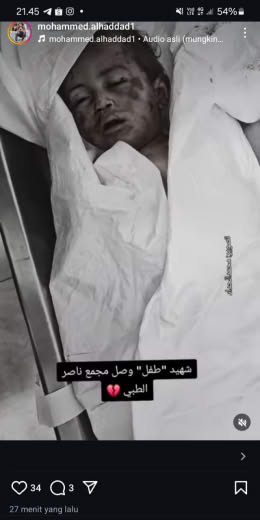 Source : Mohammed Alhaddad