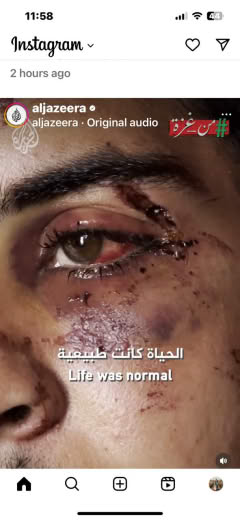 26/2/24 Al Jazeera