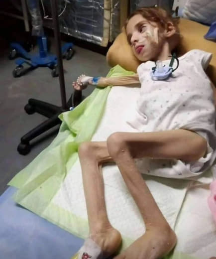 Famine in Gaza due to the Nazi terrorist Israeli occupation Famine in Gaza due to the Nazi terrorist Israeli occupation