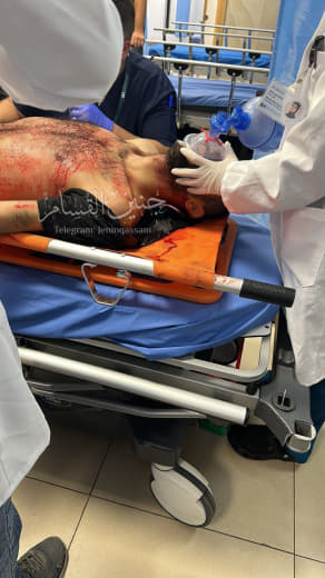 Injuries by occupation bullets in Jenin