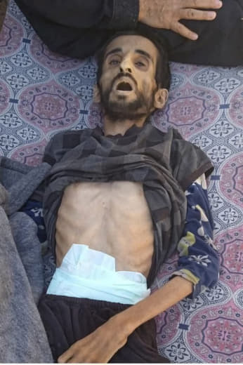 A young man died as a result of hunger in Gaza