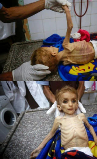 She died of starvation in Gaza a short while ago 🇵🇸