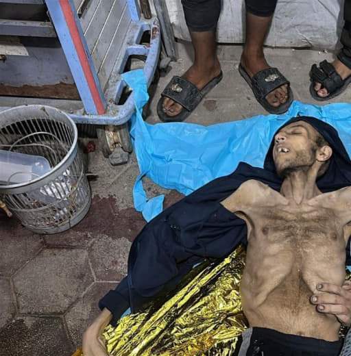 A young man dies as a result of hunger in Gaza now