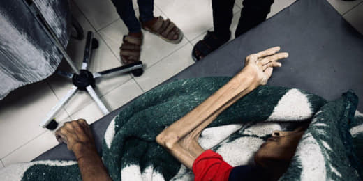 A young man dies as a result of hunger in Gaza now