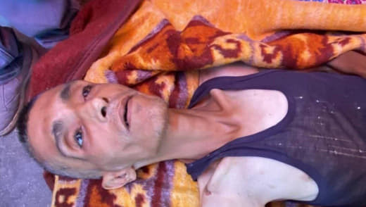 A young man dies as a result of hunger in Gaza now