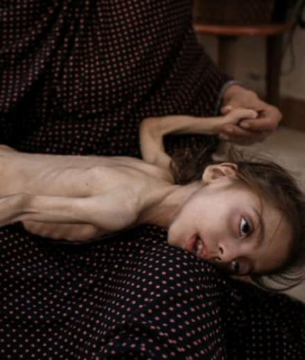 “In Gaza, one person is declared dead every hour due to hunger.”