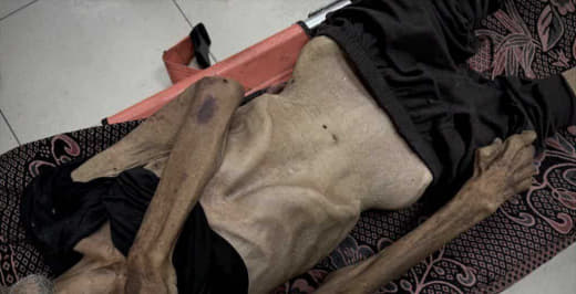 An elderly man has now died of starvation in Gaza