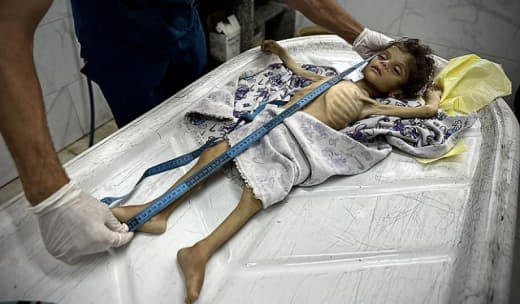 From 20 kilos to less than 2 kilos... to die of hunger and complain to God about the failure of those near and far. Anno