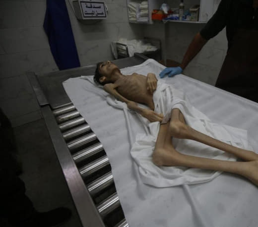 A young man and a girl died of hunger in Gaza now 🇵🇸