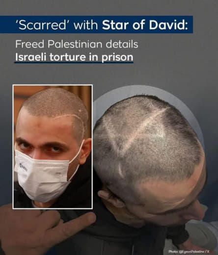 The man pictured is Musab Qatawi, a Palestinian from the city of Qalqilya, who was released on April 10, 2025, after ser