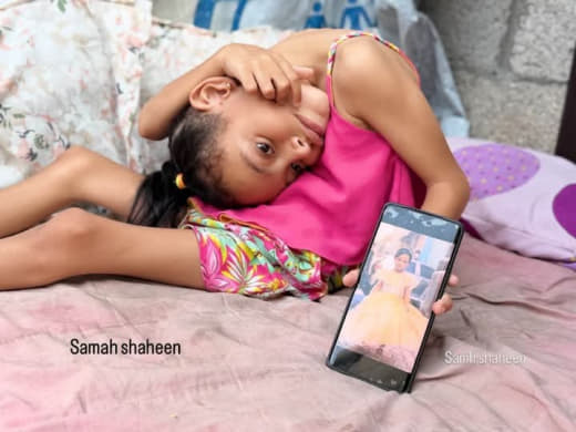 The child Sila Abu Karim (6 years old) was injured by shrapnel in front of her home in the Al-Maghazi camp in central Ga