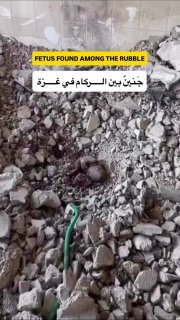"A fetus found outside its mother's womb"... from among the rubble of an apartment targeted by the occupation in the Al-