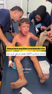 Two people, including a child, were martyred, and others—mostly children—were injured as a result of an Israeli bombing 