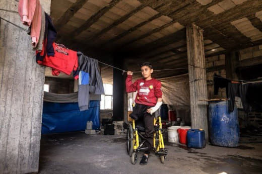 🇵🇸🌹 Gaza: Mohammed al-Mubayyid, 12 anos, perdeu a perna e vários familiares num ataque israelense em Al-Zeitoun. Apesar 