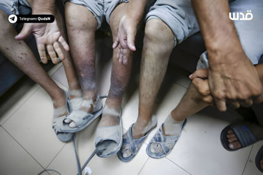 Newly released Palestinian prisoners from Gaza show signs of torture and mistreatment in the infamous Israeli detention 