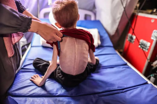UNRWA Media Office official Enas Hamdan says 5,000 children in Gaza are suffering from severe malnutrition due to the sh